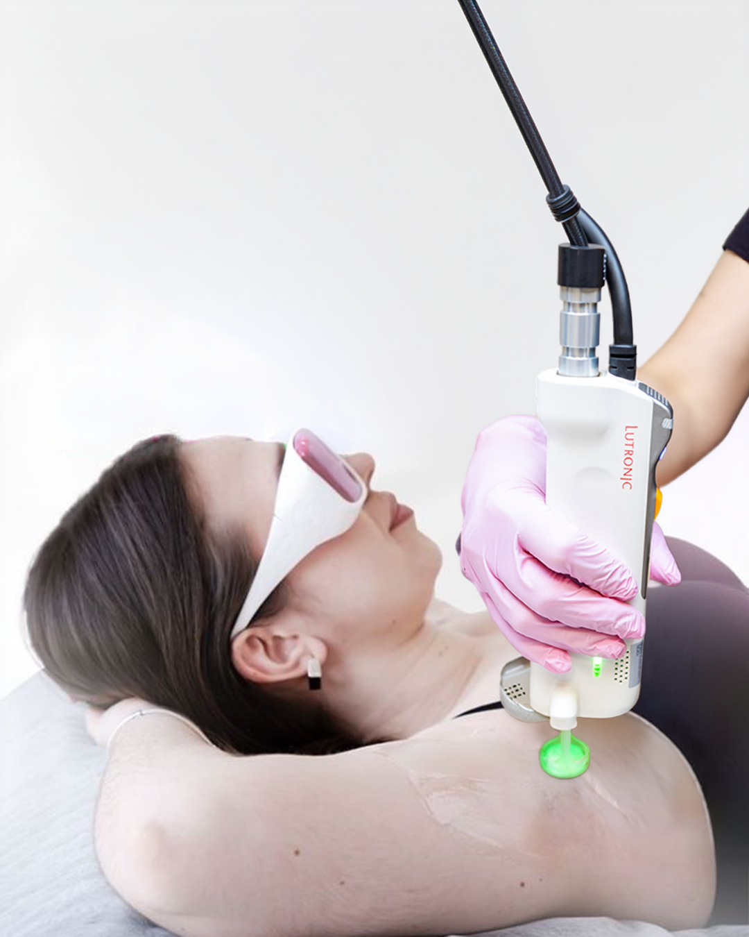 Épilation laser Clarity II